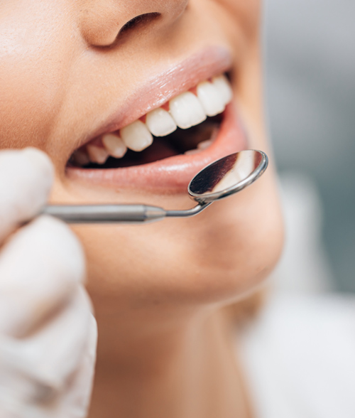 close up of a woman's smile with a dental mirror reflecting her teeth emphasizing dental health and oral hygiene