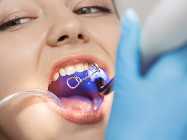 dentist performing treatment on patient with dental tool blue light two dental care procedures