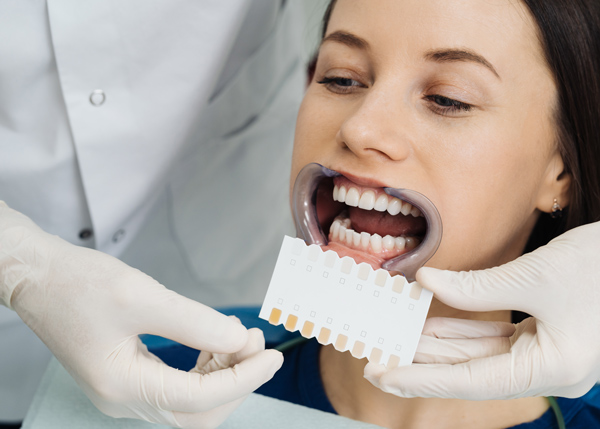 woman undergoing dental checkup with color shade guide for teeth whitening and brightening assessment using 7 color options