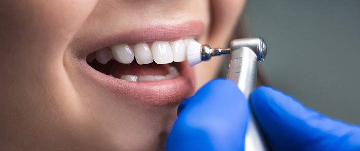 person receiving dental cleaning with teeth whitening procedure using dental tool